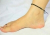 Woman-black-thread-in-anklet-reason-