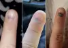 Nail-color-health-warning-signs
