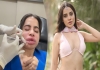 Urfi-javed-lip-filler-removal-shocking-video