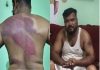 Bjp-leader-sunil-assault-allegation-delhi