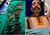 40-knives-removed-from-stomach