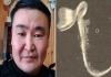 Seed-sprouted-inside-russian-mans-eye