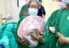 Rare-ovarian-cyst-surgery-in-pune