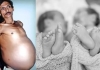 Nagpur-man-lived-with-twin-inside-stomach