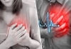 Heart-attack-causes-symptoms-prevention-tips