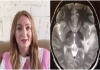 Uk-woman-neurocysticercosis-india-trip-tapeworm-brain-i