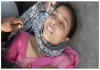 Incorrect-cpr-causes-rib-fracture-to-school-teacher-in-