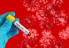 Nipah Virus Alert: Tamil Nadu Intensifies Border Surveillance Amid Kerala Outbreak