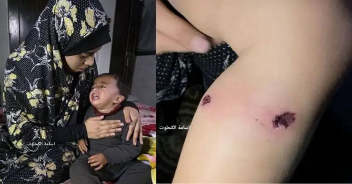 gaza-child-torture-israel-controversy