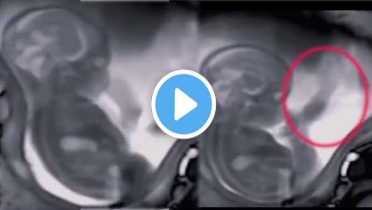 Twin babies in mother womb cute video
