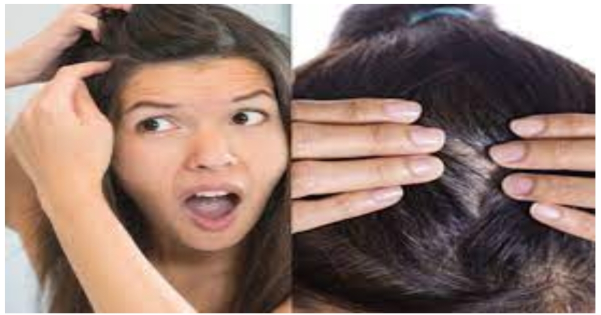 Are you suffering from gray hair? Eat this and see the change yourself..!