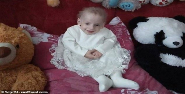 8 years old baby died in Ukraine for old age 