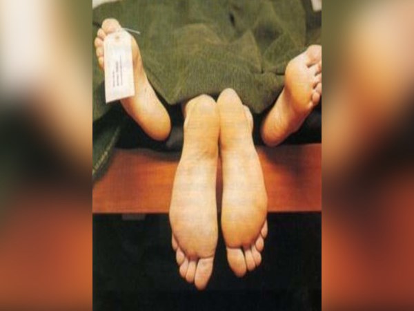 sec with dead body in america