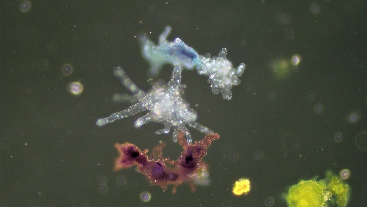 US texas brain eating amoeba found in drinking water
