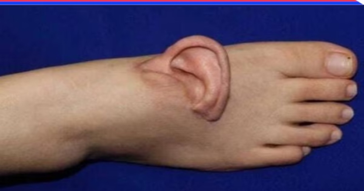 china-woman-ear-saved-leg-surgery