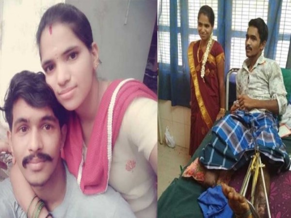 Girl married a man who lost his one leg on train accident