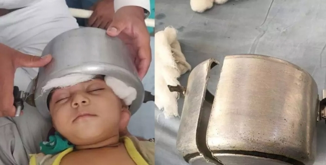 Child head struggled in cooker at gujarat