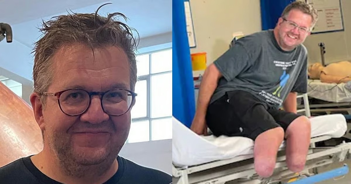 uk-doctor-leg-removal-insurance-fraud