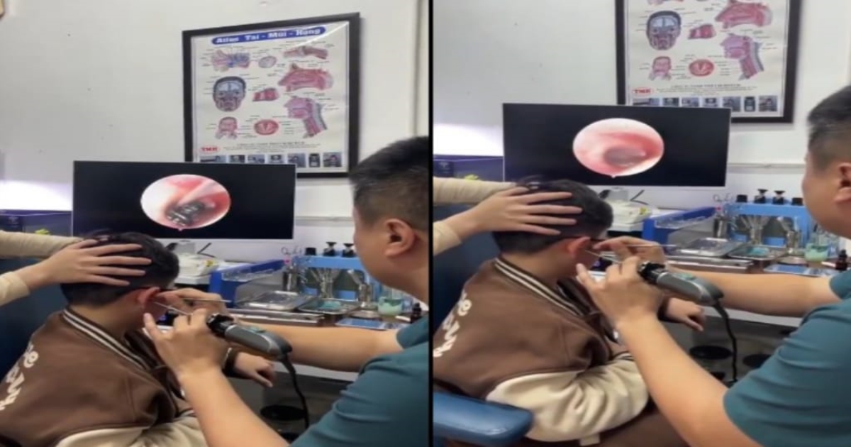 vietnam-boy-ear-screw-removed-safely