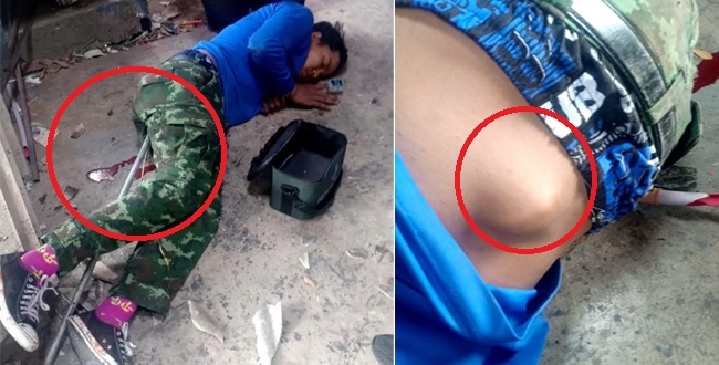 builder-gets-metal-rod-stuck-up-his-bum-after-slipping