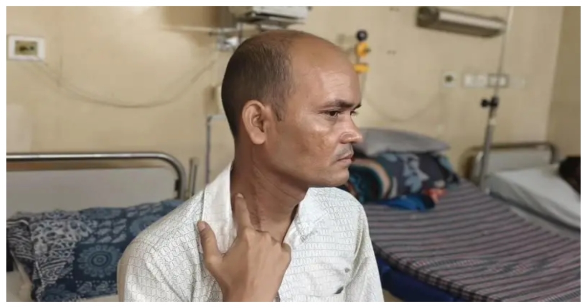 toothbrushing-rare-carotid-artery-rupture-incident