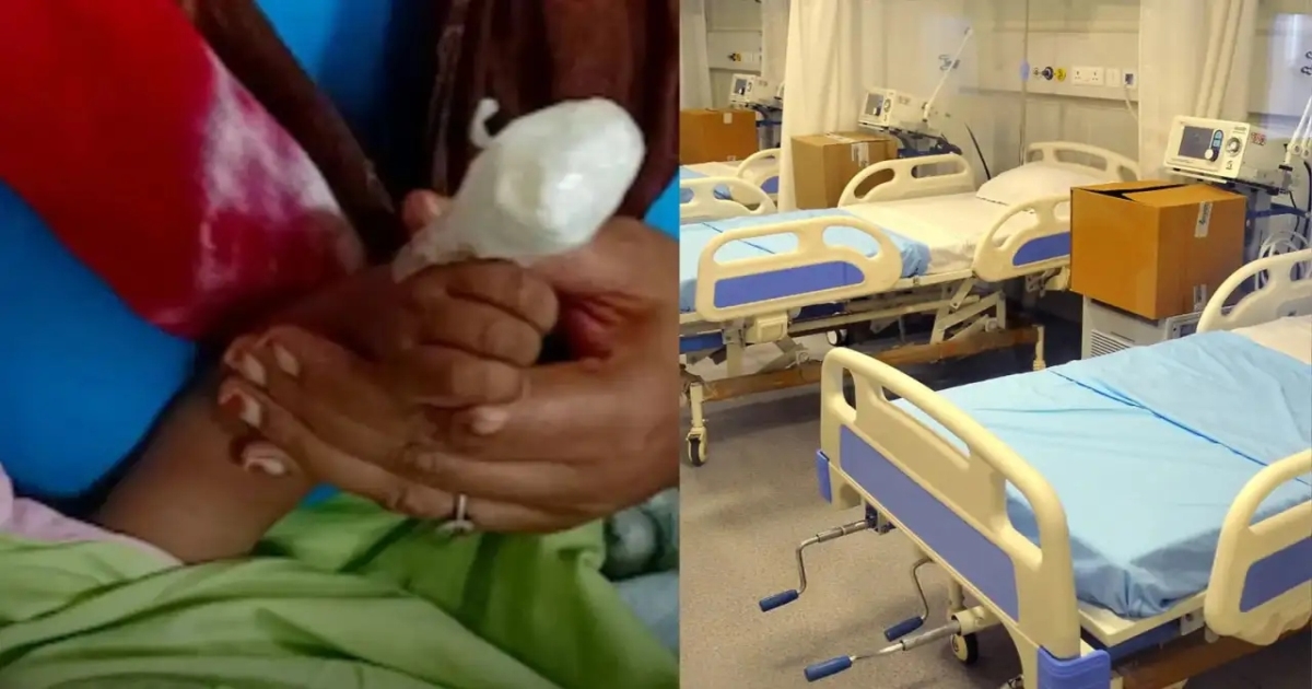 bengaluru-hospital-nurse-negligence-baby-finger-incident