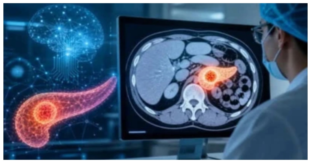 Ai-detects-pancreatic-cancer-early-breakthrough