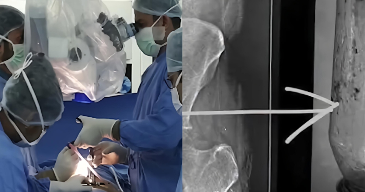young-woman-bottle-removal-surgery