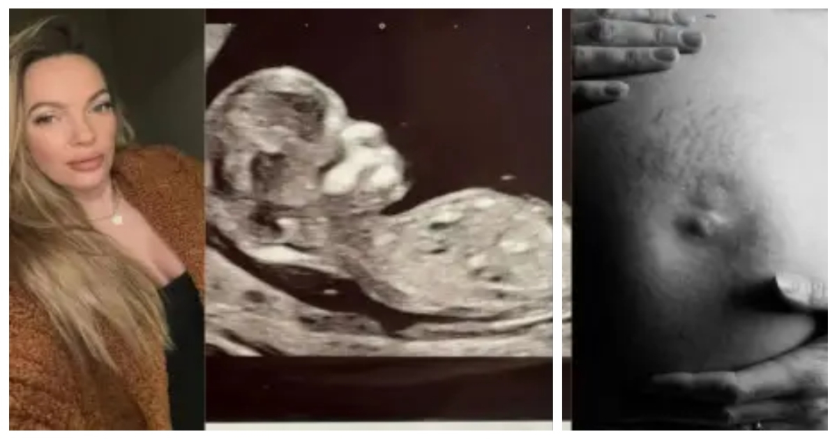 woman-gives-birth-without-intercourse-uk