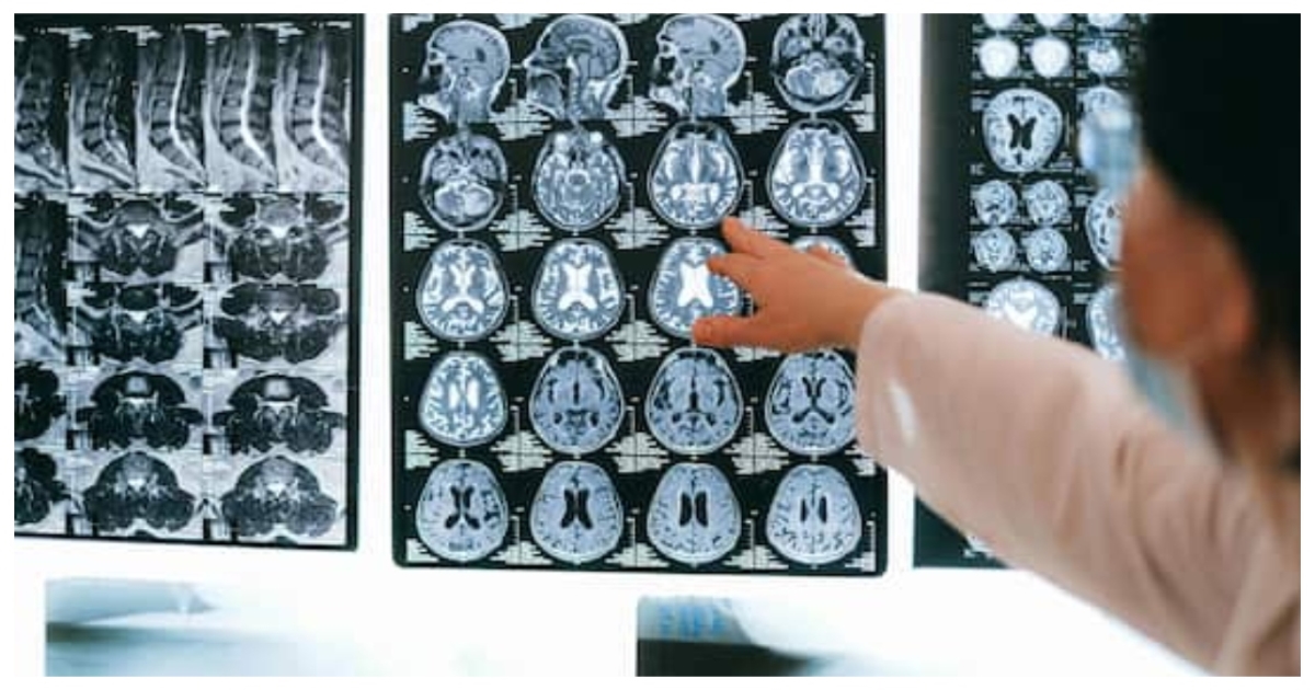 male-brain-shrinkage-aging-study