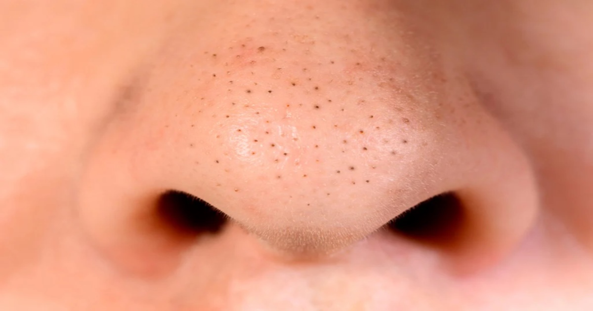 Black Heads and White Heads