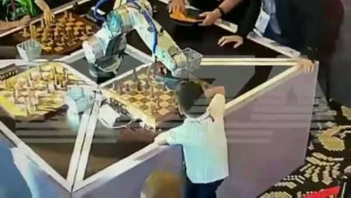 Robo breaks boys finger