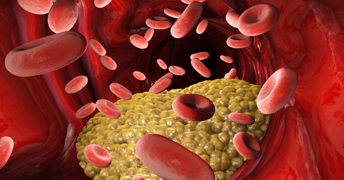 Home remedies for cholesterol 
