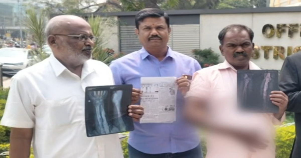 Shocking Medical Negligence in Coimbatore: Surgical Stapler Found Inside Patient’s Hand After Operation