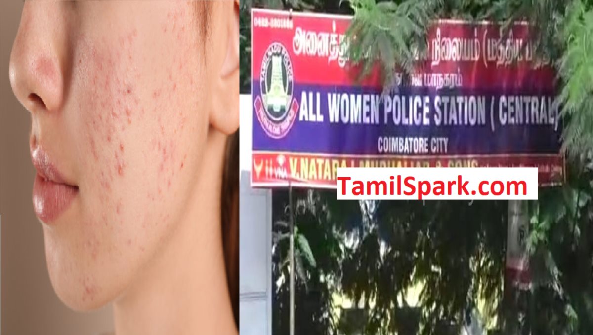Coimbatore Woman Husband torture about Pimple and Nude Video Intimation 