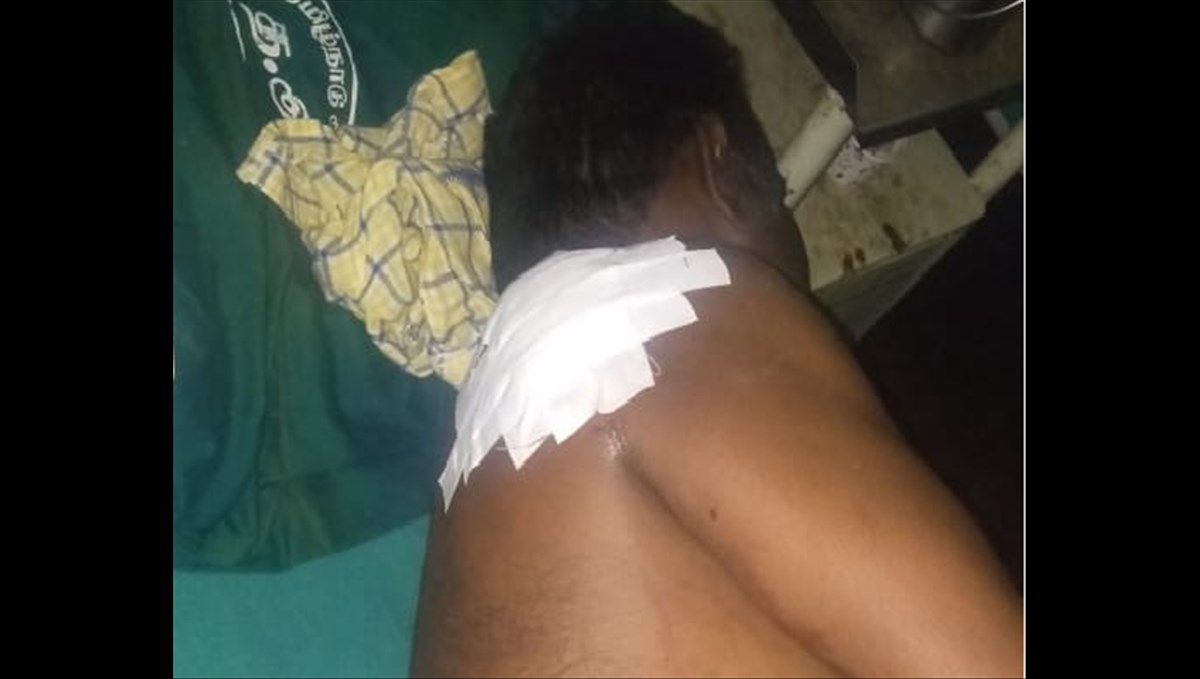 man-attacked-by-drunken-young-boy-in-alangudi
