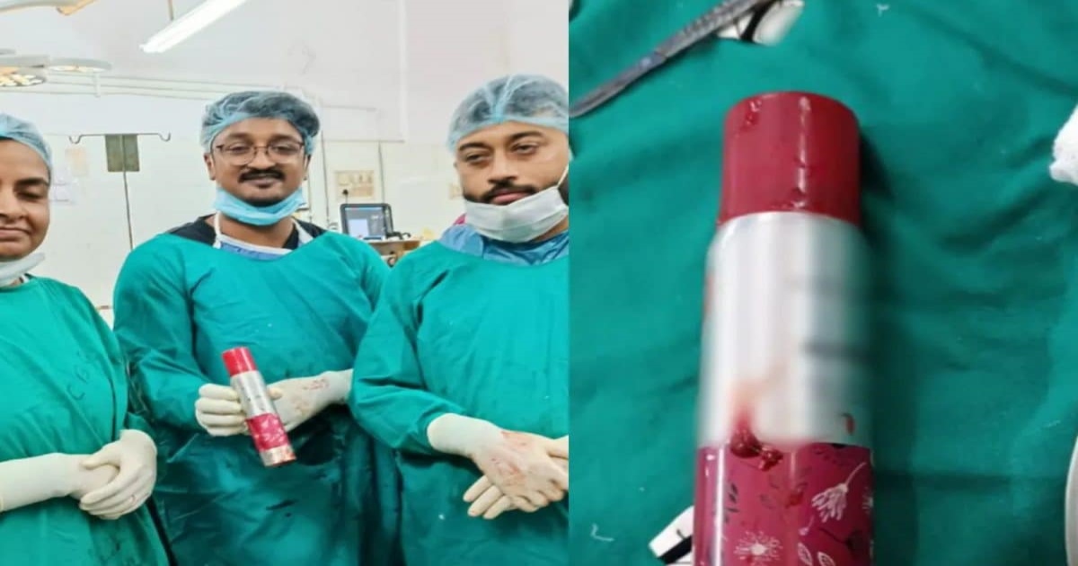 Perfume bottle removed from man stomach