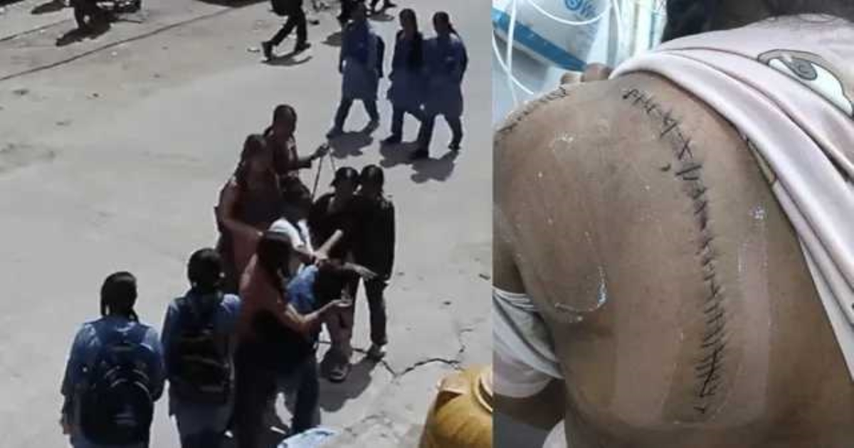 delhi-rogini-schoolgirl-attack