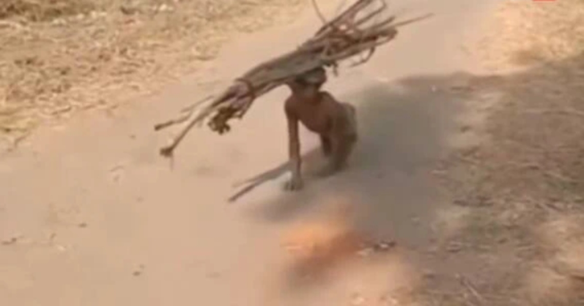 disabled-boy-viral-video-poverty-struggle