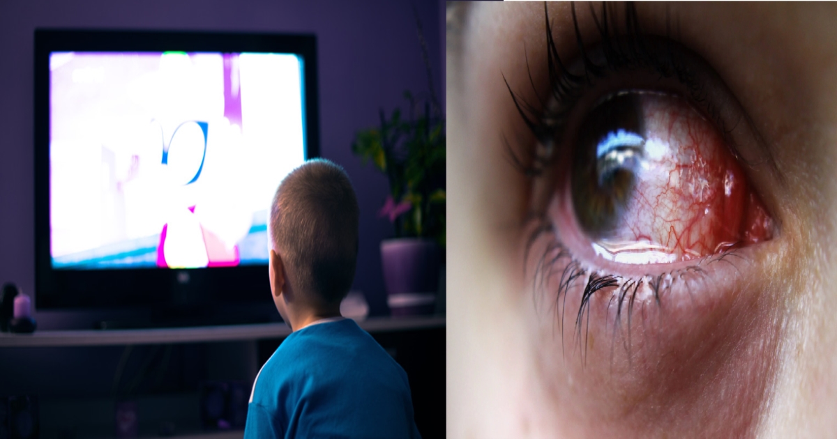 Watery Eyes While Watching TV? This Could Be a Warning Sign for Your Eyes 