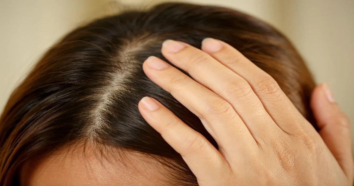 Head Dry Problems and Solution 