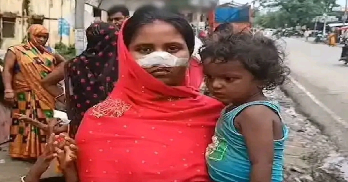   Uttar Pradesh Man Cut Nose of Wife 