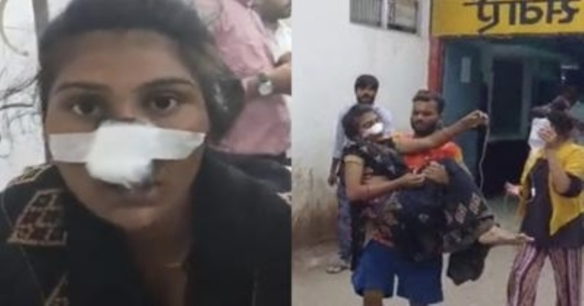 in Uttar Pradesh Harodi Husband Cut off Wife Nose 