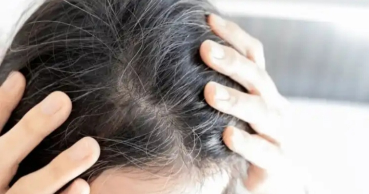 These foods are help to control grey hair