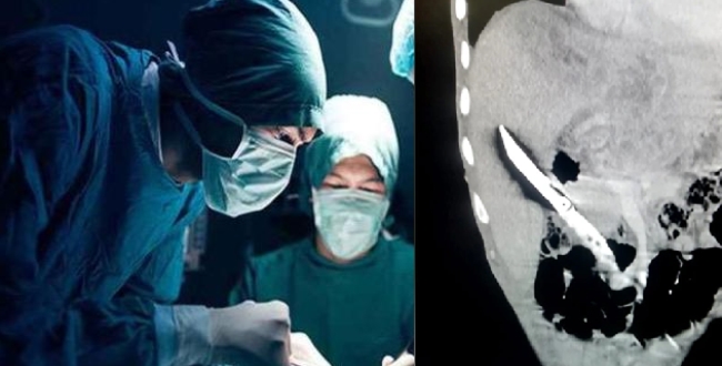 knife in young man liver