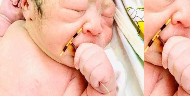 newborn-captured-grabbing-mums-iud-that-failed-to-stop