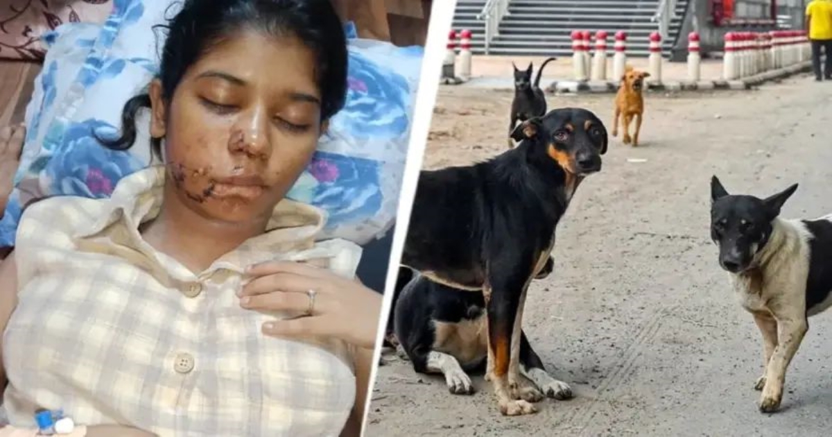 kanpur-student-dog-attack
