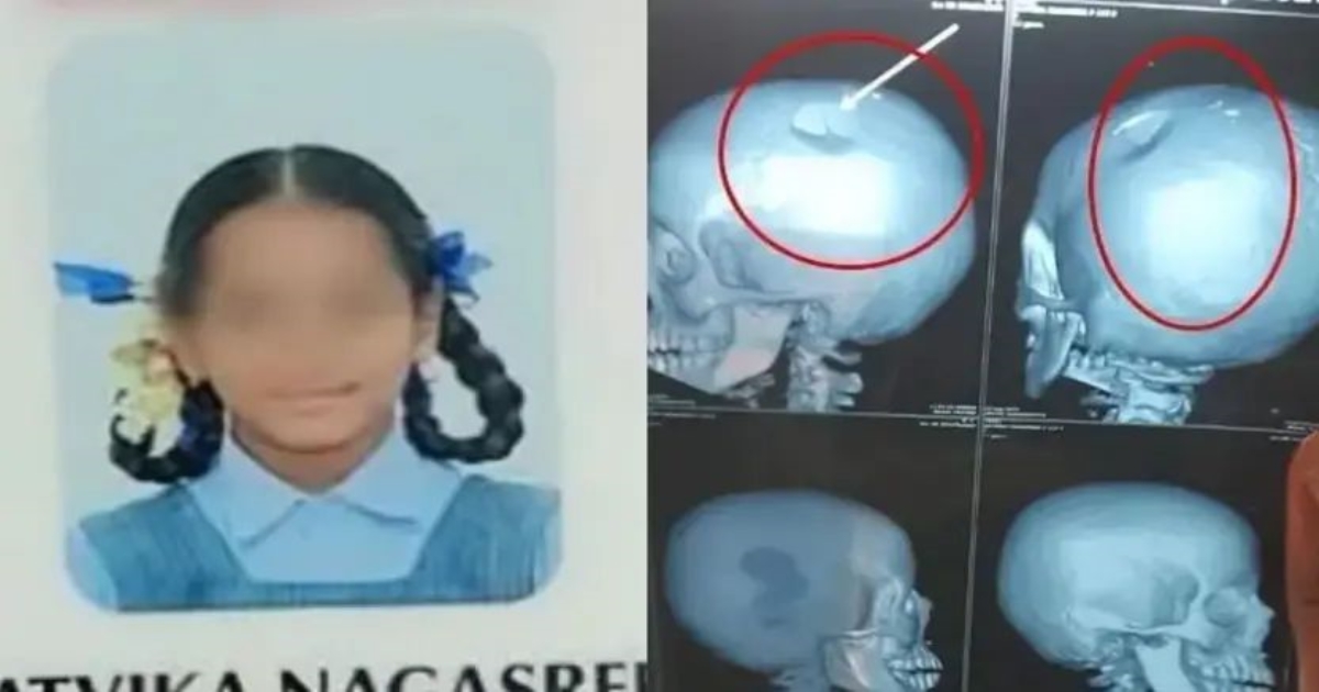 student-injury-chittoor-school