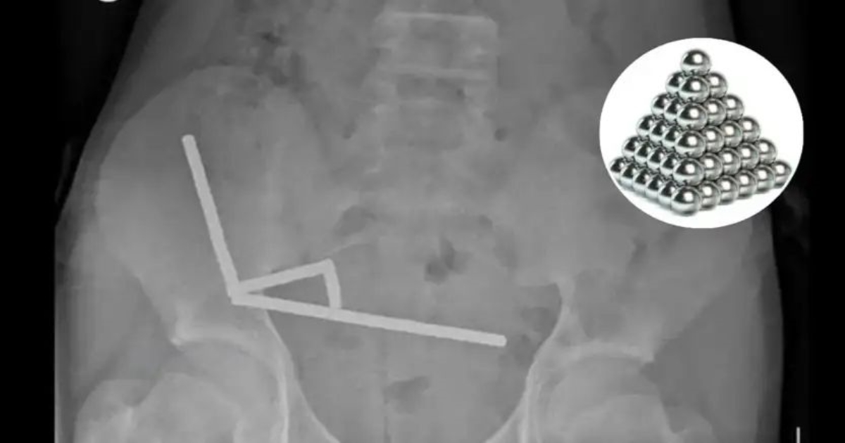 nz-teen-magnet-incident