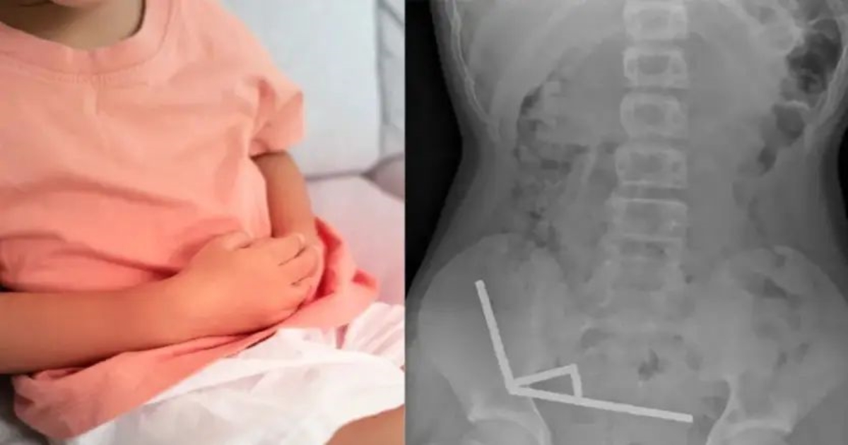 nz-kid-magnet-accident-digital-safety-warning